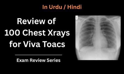 Review of 100 Chest Xrays for Viva Toacs