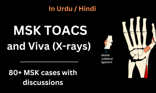 MSK TOACS and Viva (X-rays)